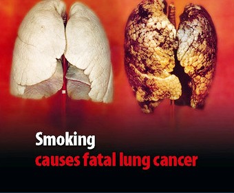 anti smoking -1