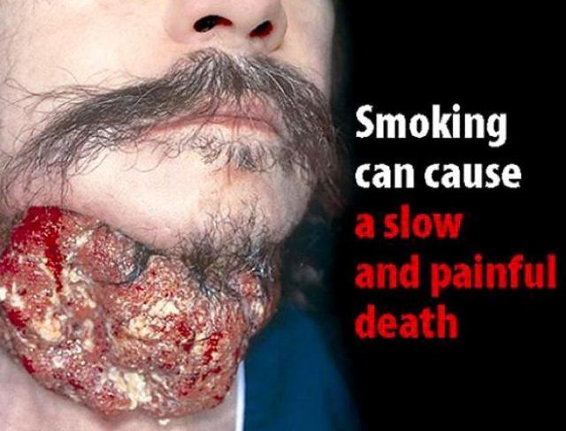 anti smoking-2